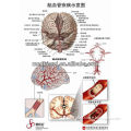 3D Medical Chart---cerebrovascular disease
